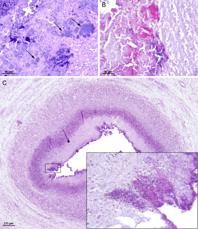 Histopathological characterisation of omphalitis in piglets.