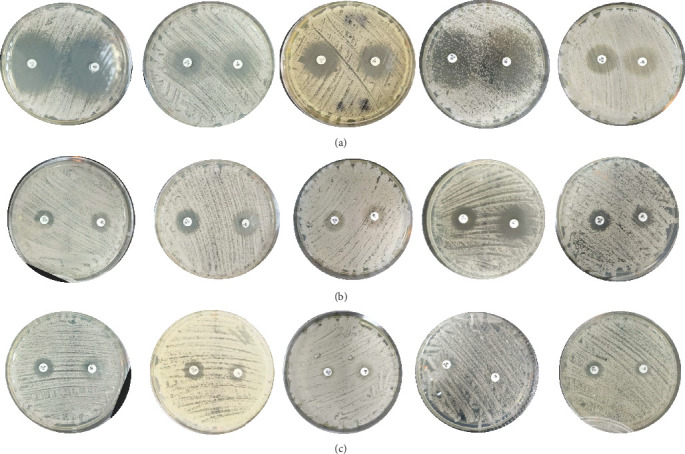 HWP1 Gene Sequence Diversity and Antifungal Susceptibility Patterns in Colombian Vulvovaginal Isolates of the <i>Candida albicans</i> Species Complex.