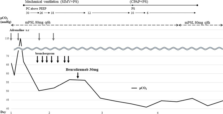 Life-threating Asthma Exacerbation Successfully Treated with Benralizumab.