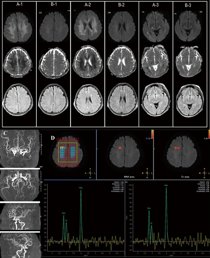Reversible Toxic-Metabolic Encephalopathy in Fluroacetamide Intoxication: A Case Report and Review of the Literature.