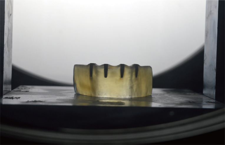 Fit analysis of implant-supported Co-Cr bars fabricated using casting, selective laser sintering, soft and dense milling techniques.