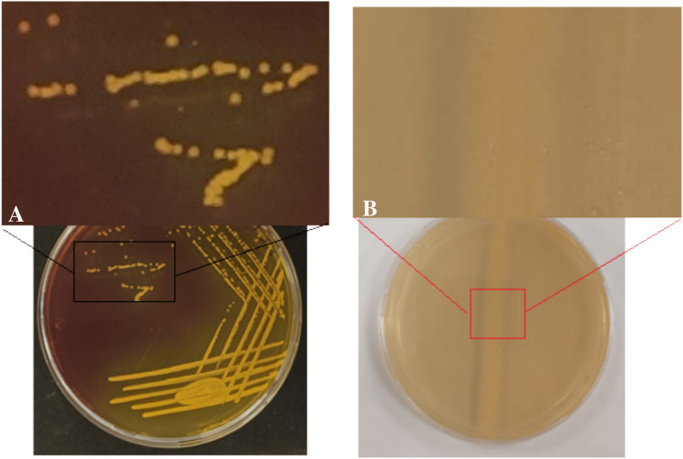 Prevalence, toxin virulence genes and investigating the effect of mutations in the tetracycline gene (tetK) on the response of methicillin-resistant Staphylococcus aureus to antibiotics: a study in sickle cell disease patients in Riyadh, Saudi Arabia.