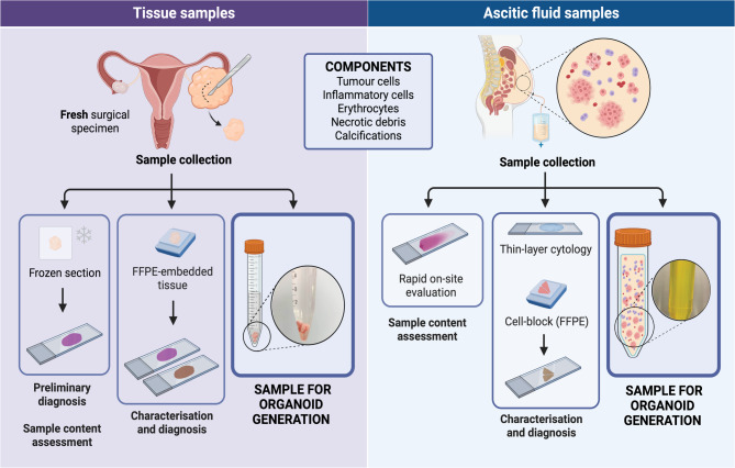 Patient-derived organoids as a model to study tubo-ovarian carcinoma: a pathologist's perspective.