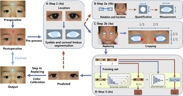 Applications of generative adversarial networks in the diagnosis, prognosis, and treatment of ophthalmic diseases.