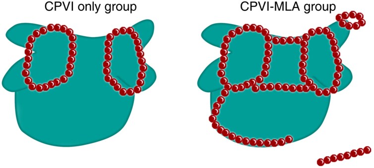 Circumferential pulmonary vein isolation with adjunctive linear ablation vs. circumferential pulmonary vein isolation alone for long-standing persistent atrial fibrillation: a randomized pilot study.