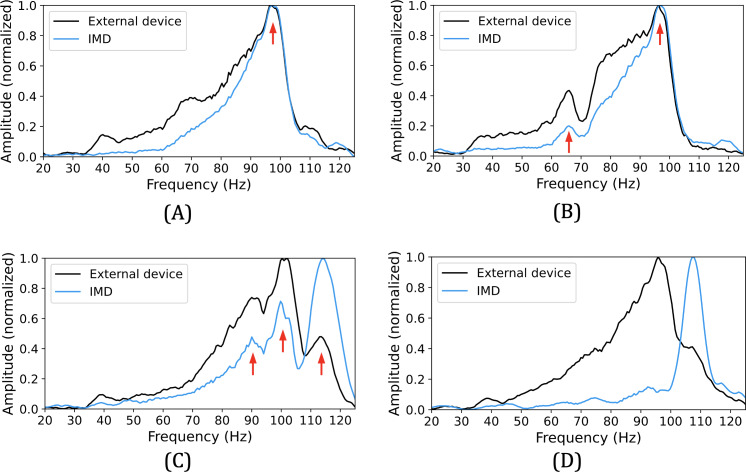 Using Vibration for Secure Pairing With Implantable Medical Devices: Development and Usability Study.