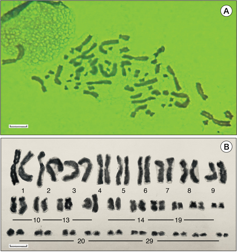 ﻿Karyotype of <i>Hynobiusfucus</i> Lai et Lue, 2008, a salamander endemic to Taiwan with comments in memory of June-Shian Lai, a pioneer in studies of mountainous salamanders (Urodela, Hynobiidae).
