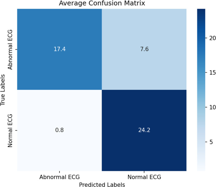 Effectiveness of the GPT-4o Model in Interpreting Electrocardiogram Images for Cardiac Diagnostics: Diagnostic Accuracy Study.