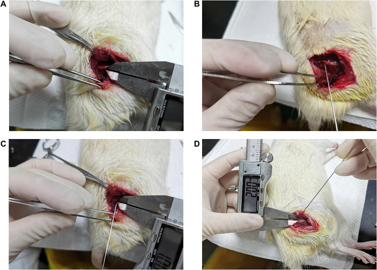 A Study of the Safety of Low Temperature Plasma Radiofrequency Ablation on Rat Sciatic Nerve.