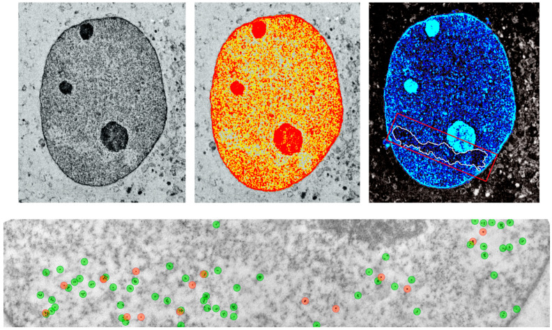 Role of Ionizing Radiation in Shaping the Complex Multi-Layered Epigenome.