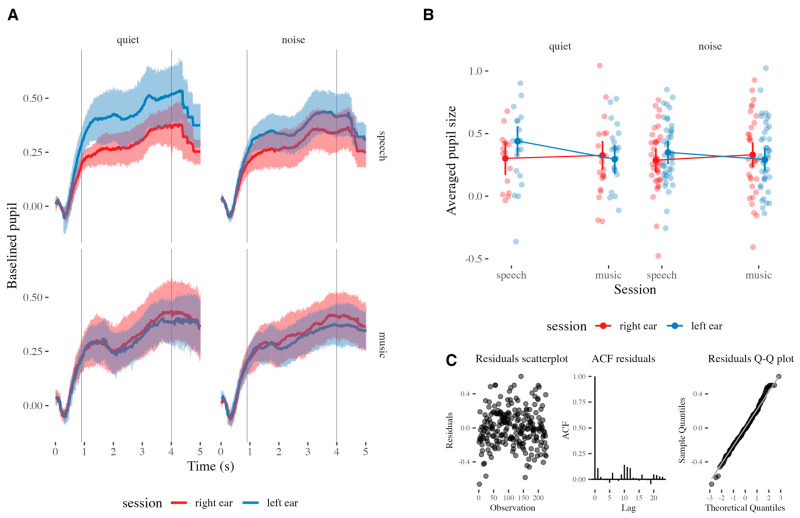 Is Pupil Response to Speech and Music in Toddlers with Cochlear Implants Asymmetric?