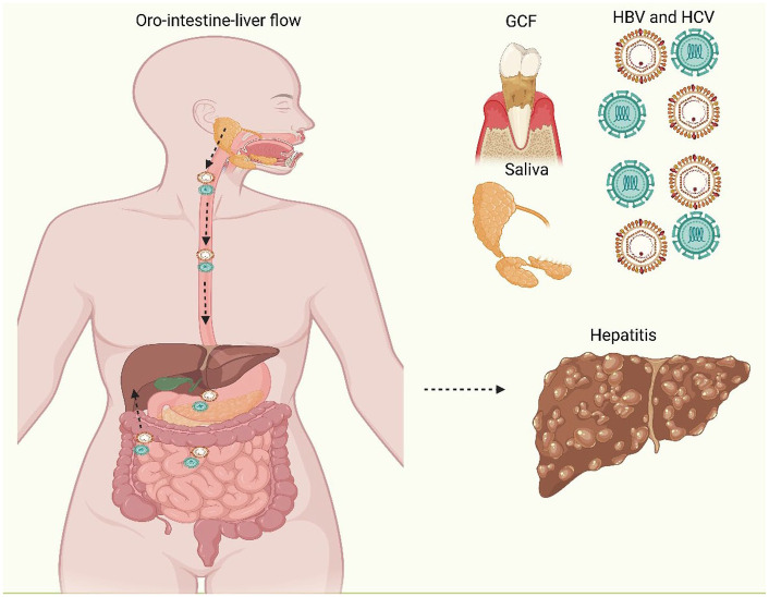Hepatitis and periodontal health: an emerging oral-liver axis.