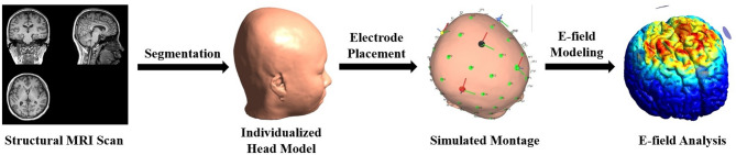 Individualized transcranial direct current stimulation combined with foot core exercise improves foot and ankle sensorimotor function and static postural control in individuals with chronic ankle instability.