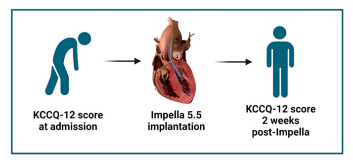 Health-Related Quality-of-Life Measures in Patients with Heart Failure Cardiogenic Shock Following Axillary Mechanical Circulatory Support.