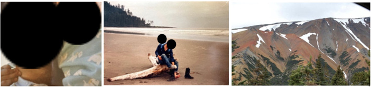 Multi-Modal Motion-Assisted Memory Desensitization and Reconsolidation (3MDR) Treatment for Postpartum Posttraumatic Stress Disorder (PTSD) from Grief: A Case Report.