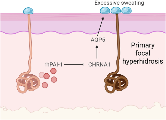 PAI-1 and CHRNA1-A new molecular axis and therapeutic target in primary focal hyperhidrosis.