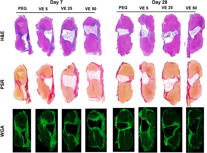 In-vivo evaluation of vitamin E loaded muscle void fillers for the provisional treatment of volumetric muscle loss.
