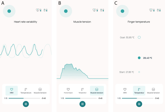 Biofeedback therapy using Cerebri for the prevention of migraine attacks in adults with episodic migraine (BioCer): a randomized, wait-list controlled trial - the study protocol.