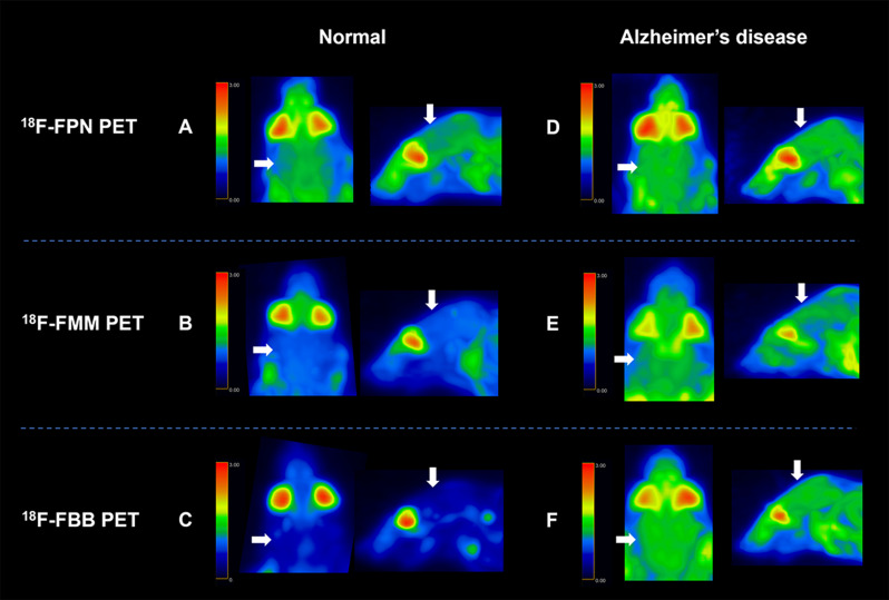 Comparative study of <sup>18</sup>F-labeled PET radiopharmaceuticals in an Alzheimer's disease mouse model.
