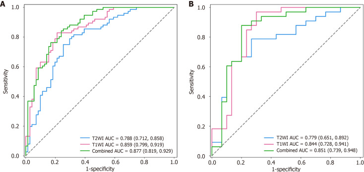 Magnetic resonance imaging-based radiomics signature for predicting preoperative staging of esophageal cancer.