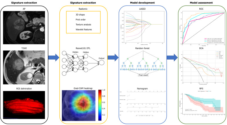 Biparametric magnetic resonance imaging-based radiomic and deep learning models for predicting Ki-67 risk stratification in hepatocellular carcinoma.