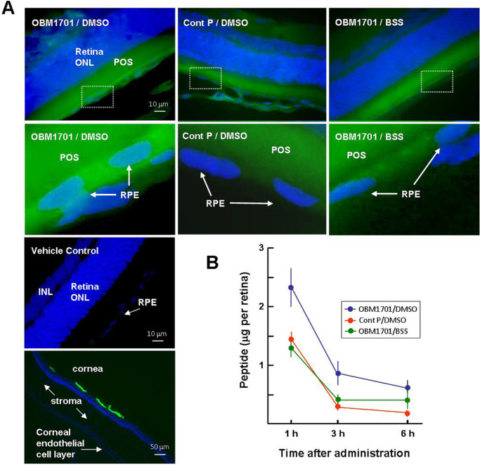 OBM1701 Alleviates Choroidal Neovascularization in Experimental Animals Via Suppressing the Expression of HIF-1α in Retinal Pigment Epithelial Cells.