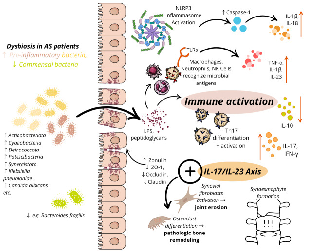 Gut microbiota and ankylosing spondylitis: current insights and future challenges.