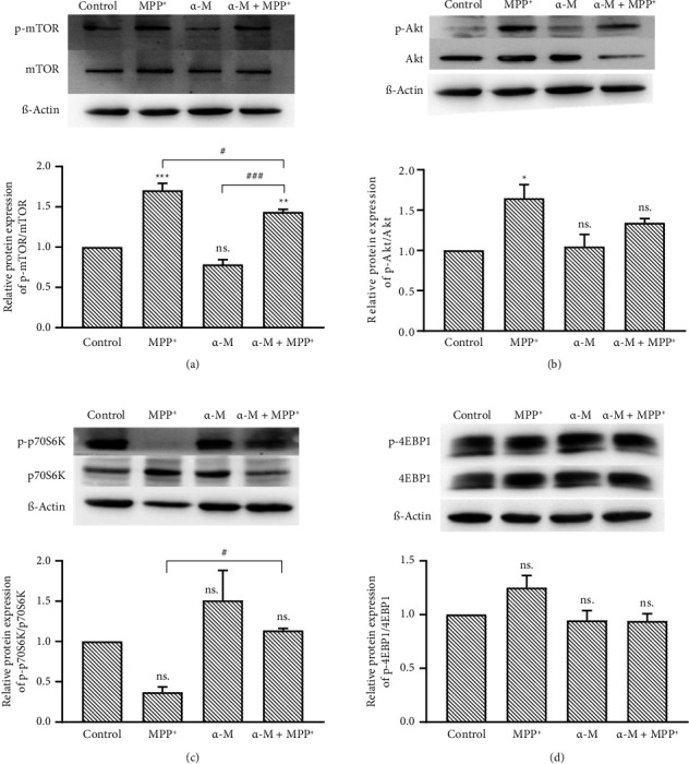 Alpha-Mangostin Alleviates Mitochondrial Damage and Autophagy Dysregulation in the MPP<sup>+</sup> Cellular Model of Parkinson's Disease.