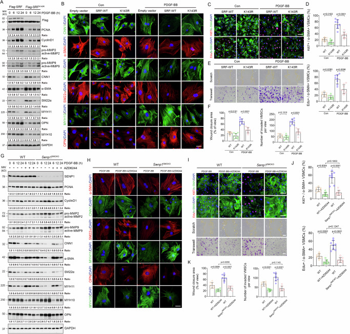 Author Correction: SRF SUMOylation modulates smooth muscle phenotypic switch and vascular remodeling.