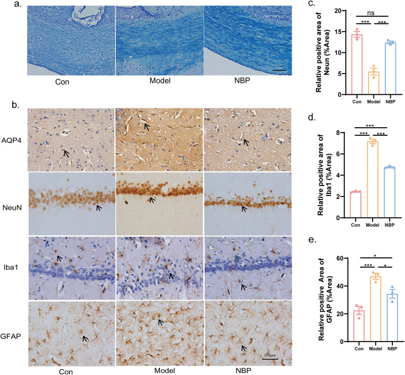 DIA-based proteomics reveals anti-inflammatory role of DL-3-<i>n</i>-butylphthalide in cerebral small vessel disease-induced brain injury in hypertensive rat.