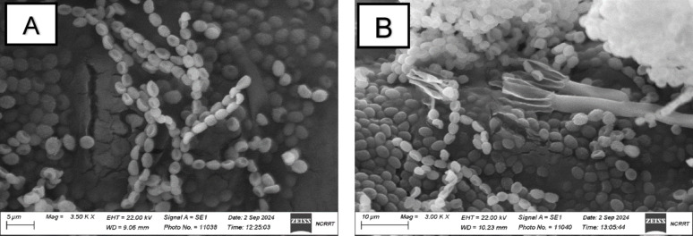 Mycofabrication of sustainable mycelium-based leather using Talaromyces sp. and irradiated eggplant peel waste.