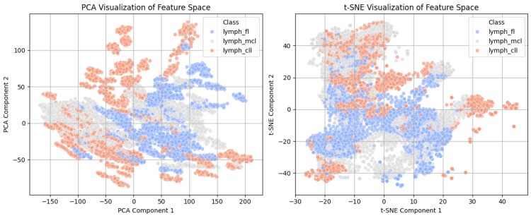 Autoencoder-Assisted Stacked Ensemble Learning for Lymphoma Subtype Classification: A Hybrid Deep Learning and Machine Learning Approach.
