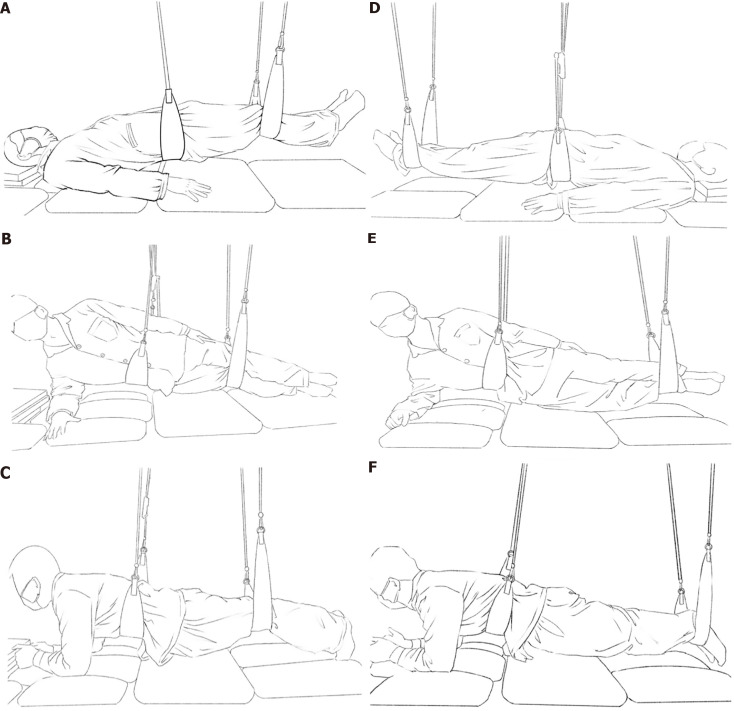 Postural correction training improves chronic pain, nerve function, and inflammation in knee osteoarthritis: A retrospective cohort study.