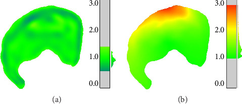 Multivariate Quantitative Outcomes of Periacetabular Osteotomy Using Discrete Element Analysis.
