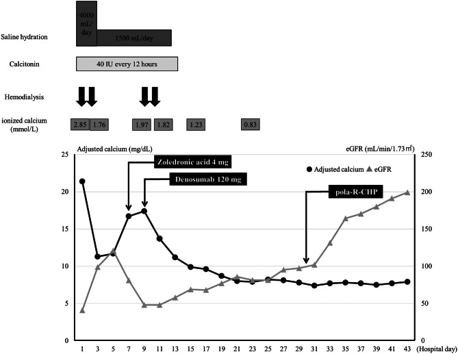 Severe hypercalcemia requiring emergency hemodialysis and multidrug therapy in a case of diffuse large B-cell lymphoma with multiple bone lesions.