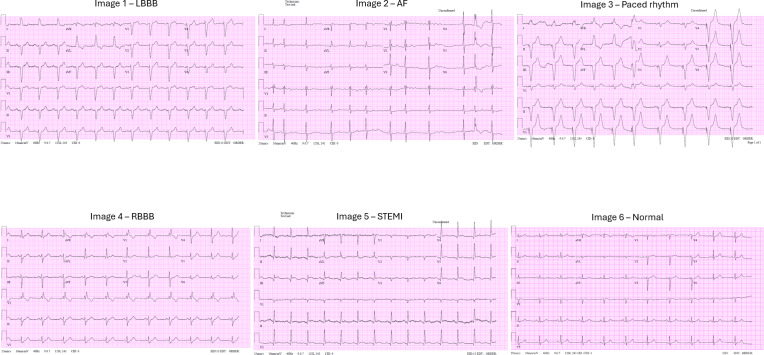 Effectiveness of the GPT-4o Model in Interpreting Electrocardiogram Images for Cardiac Diagnostics: Diagnostic Accuracy Study.