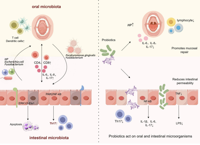 Microbiological mechanisms of oral mucosal disease: oral-intestinal crosstalk and probiotic therapy.
