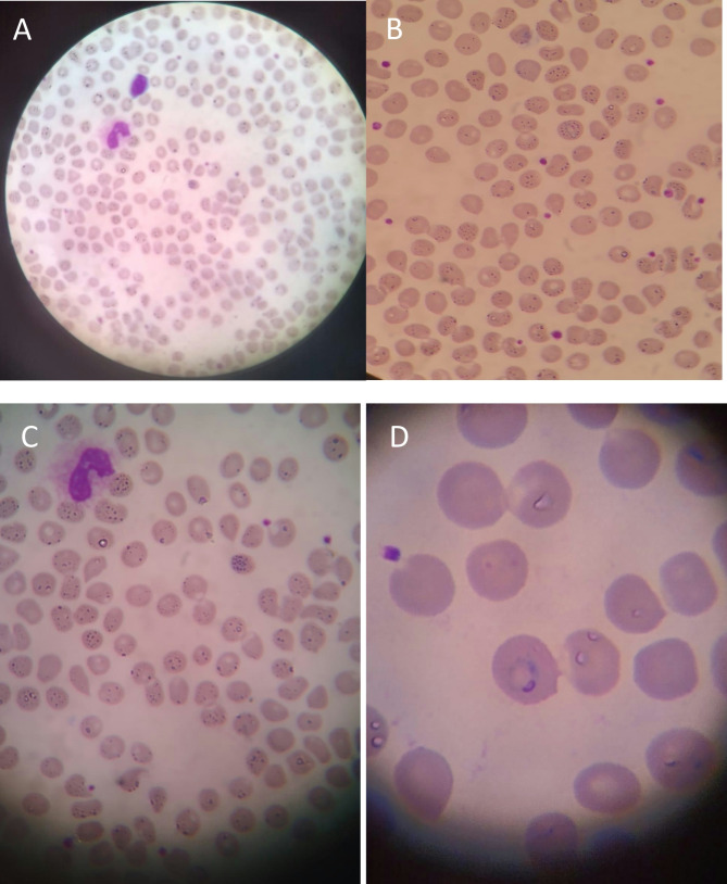 Imported plasmodium ovale malaria from Côte d'Ivoire: a case report.