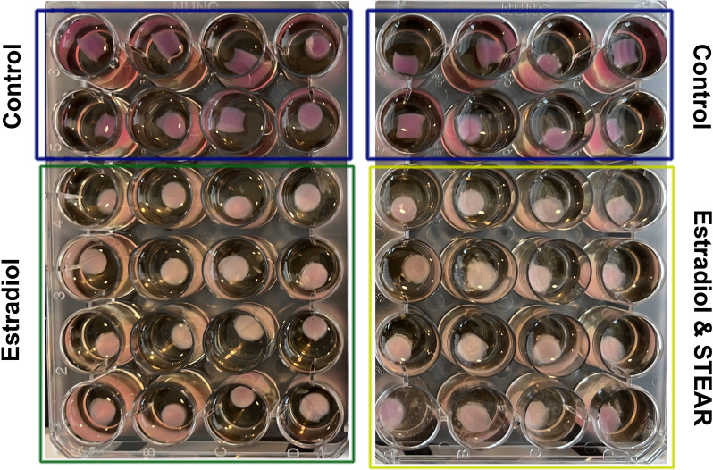 Corneal enzymatic digestion resistance in the presence of oestradiol and oestradiol plus selective tissue oestrogenic activity regulators (STEAR).