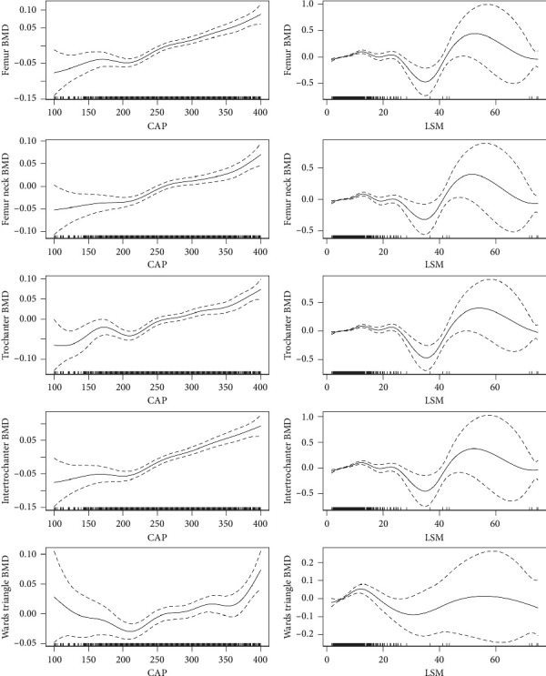 Increased BMD in SLD Patients Without Advanced Hepatic Fibrosis: Evidence From the NHANES 2017-2020 Database.