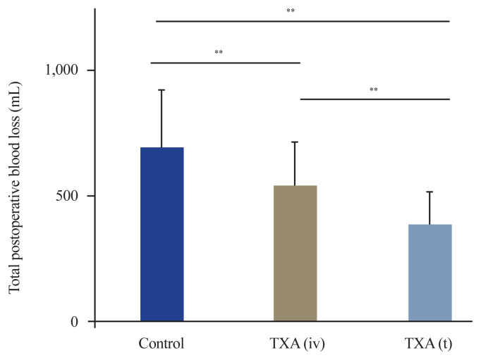 Comparison of topical and intravenous tranexamic acid for reducing postoperative blood loss in single-level posterior lumbar interbody fusion: a retrospective study from Japan.
