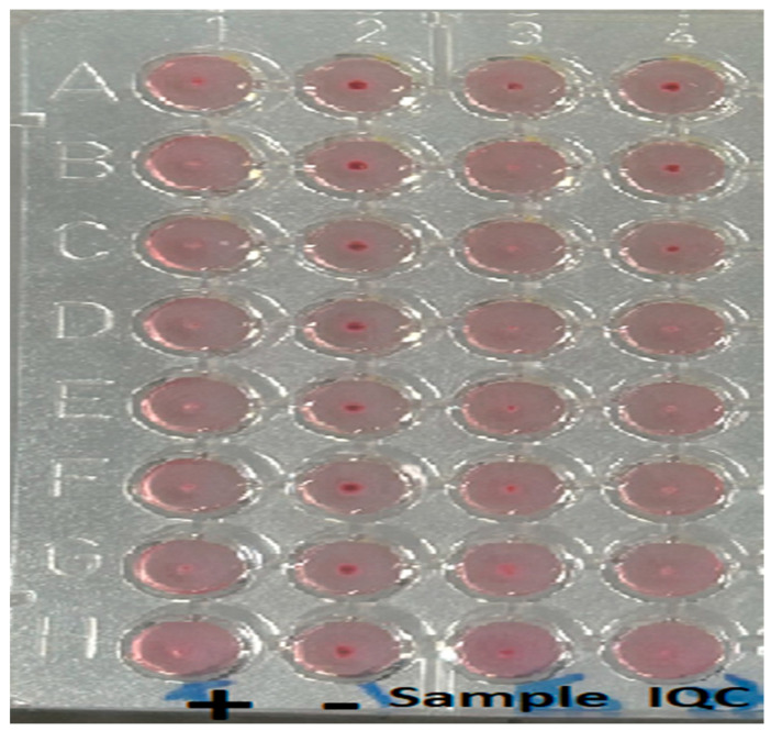 A Family Cluster of Imported Human <i>Brucella melitensis</i> Infection with Probable Breast Milk Transmission: A Case Series.