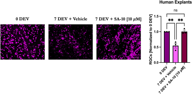 Hybrid molecule SA-10 and its PLGA nanosuspension protect human and rodent retinal ganglion cells against neuronal injury.