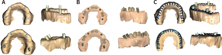 <i>In vitro</i> evaluation of the effect of auxiliary geometric device on measurement trueness and scanning time in full-arch implant impressions.