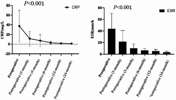 Clinical efficacy analysis of one-stage posterior debridement, bone graft fusion, and internal fixation for the treatment of lumbar brucellosis spondylitis.