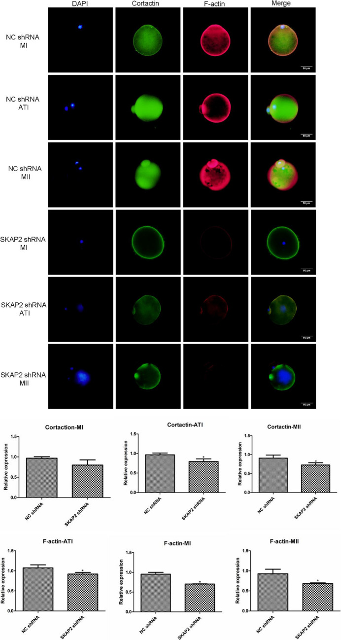 Expression and Regulatory Roles of SKAP2 and Cortactin in Mouse Ovarian Tissue and Oocyte Maturation.