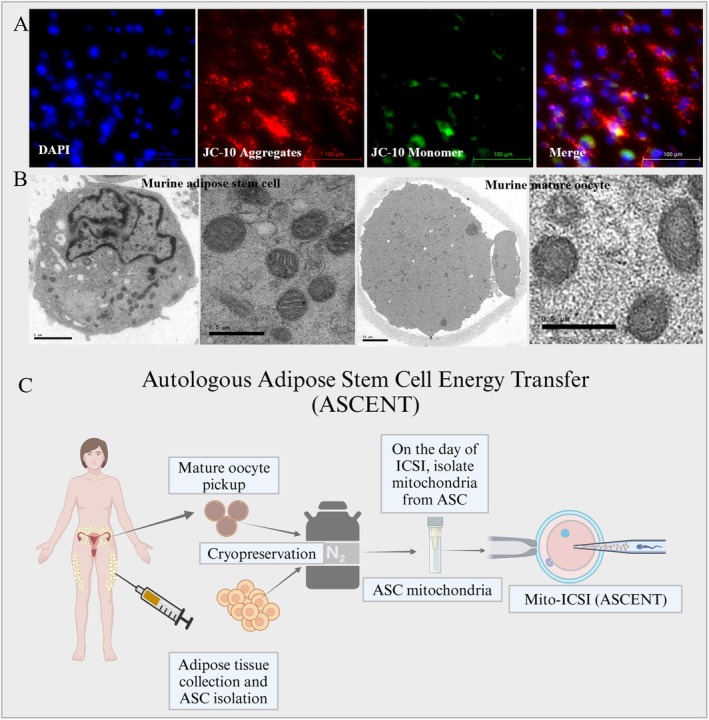 Significance of Mitochondrial Dynamics in Reproductive Physiology: Current and Emerging Horizons in Mitochondrial Therapy for Assisted Reproductive Technologies.