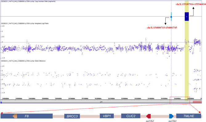 Identification of an F8 complex recombination in Chinese hemophilia a patient using long-read sequencing and optical genome mapping.