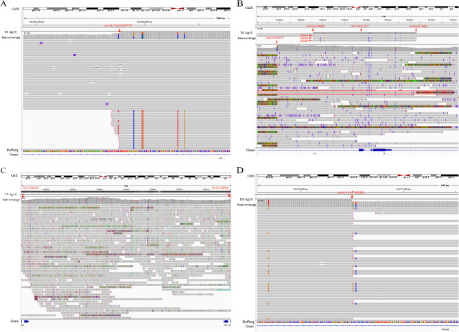 Identification of an F8 complex recombination in Chinese hemophilia a patient using long-read sequencing and optical genome mapping.