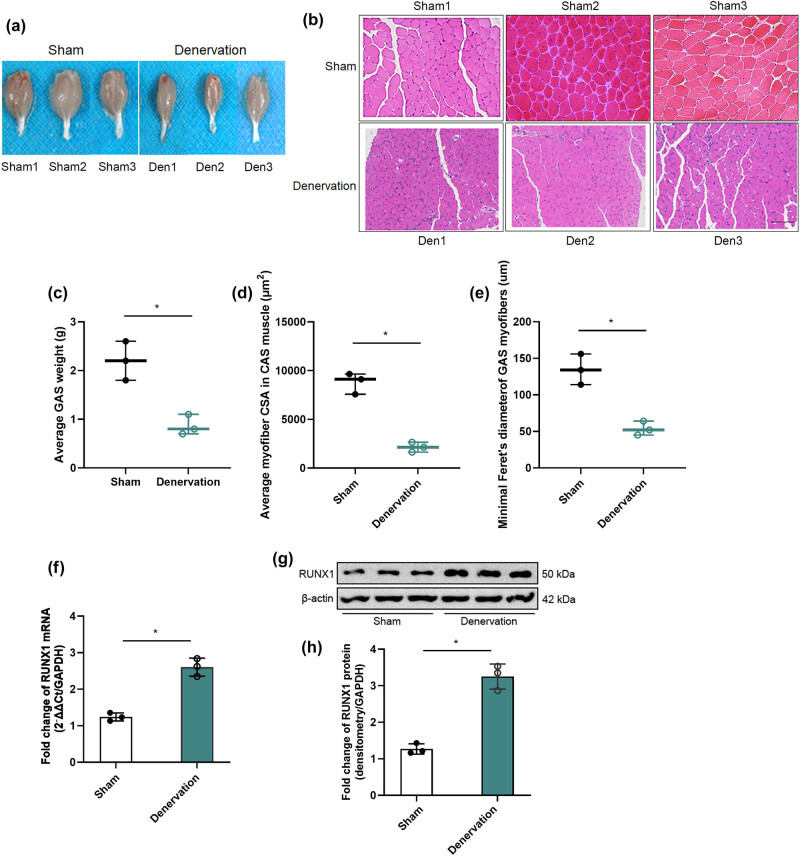 RUNX1 promotes denervation-induced muscle atrophy by activating the JUNB/NF-κB pathway and driving M1 macrophage polarization.
